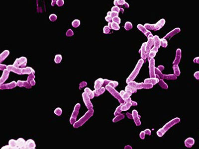 性病有什么特征