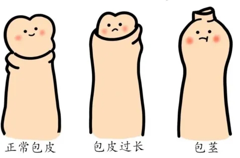 ��Ƥ�е㳤��Ҫ����