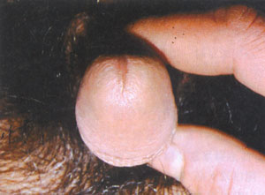 �Ϻ���������ҽԺ